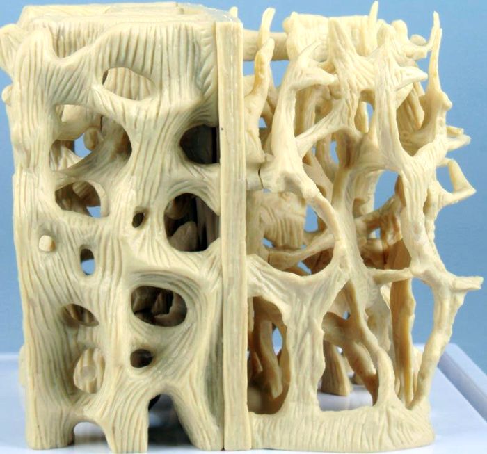Vergleichsmodell gesunde / osteoporotische Knochenstruktur, Bestellnummer 4062