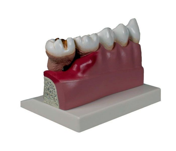 Dentalmodell, 4-fache Größe, Bestellnummer D250