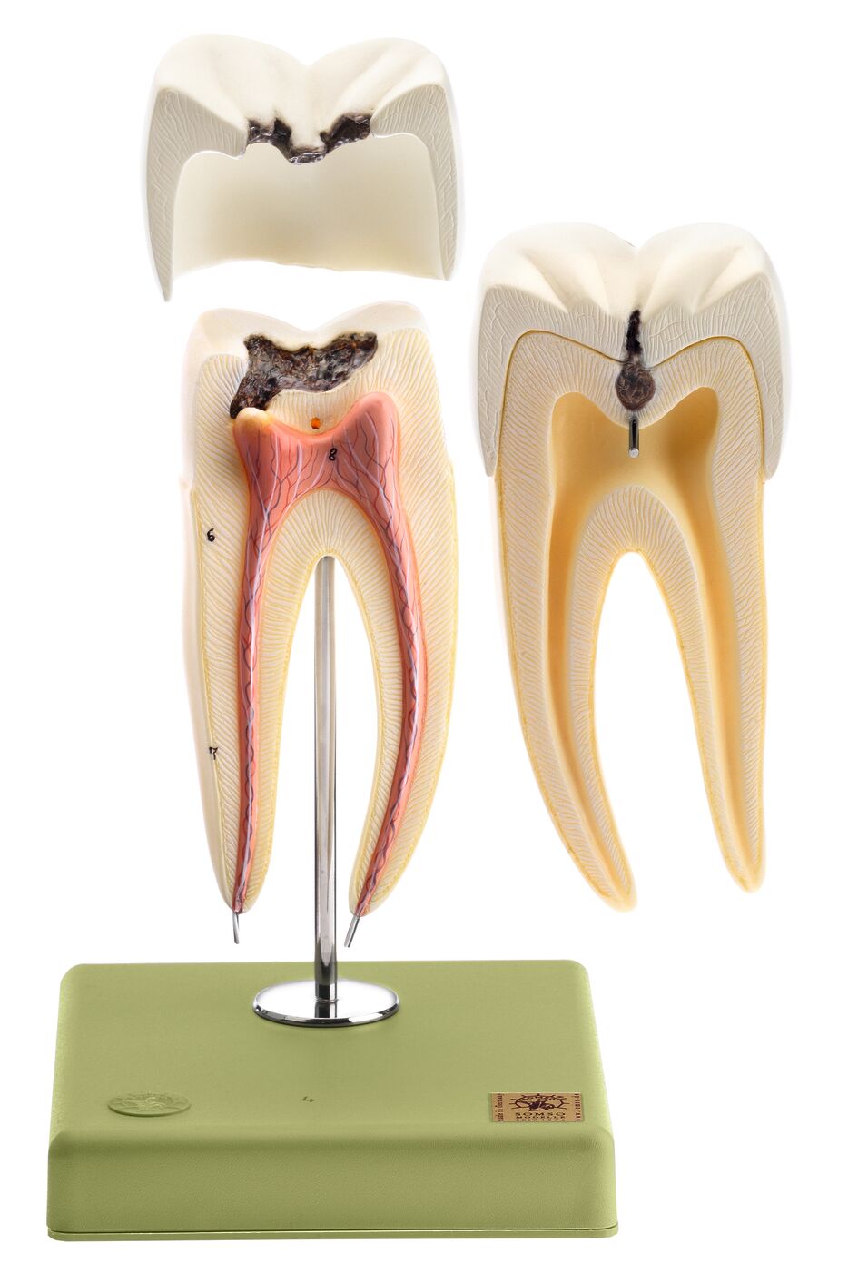 Lower Molar with Two Roots