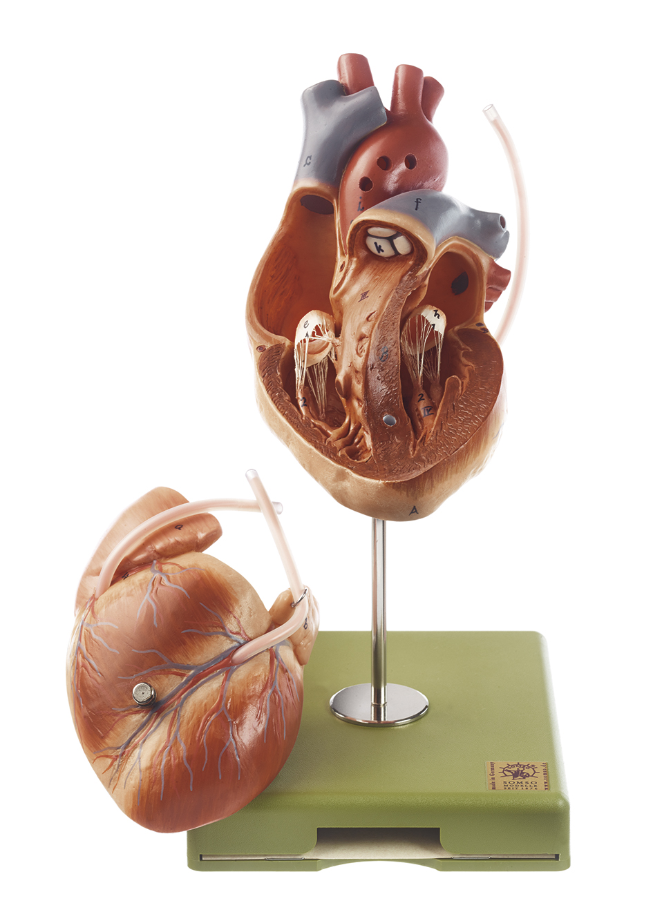Model of the Heart with Bypass Vessels(Aortic Coronary Venous Bypass)