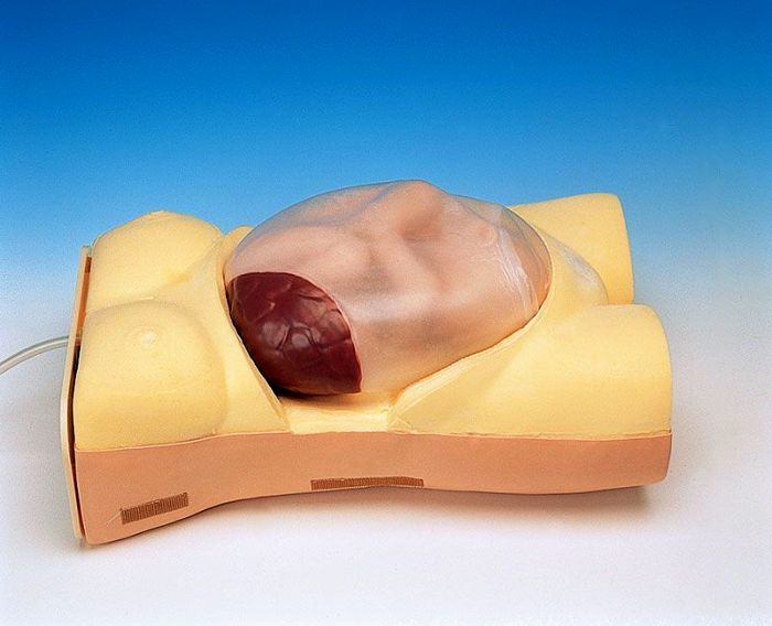 Schwangerschafts-Untersuchungs-Modell mit Herzton-Simulation, Bestellnummer LM43N