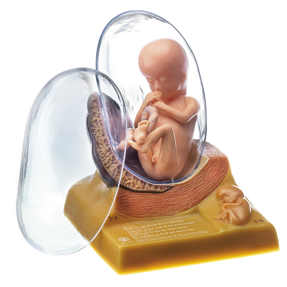 Menschlicher Embryo im 3. Monat, Bestellnummer MS 11/3