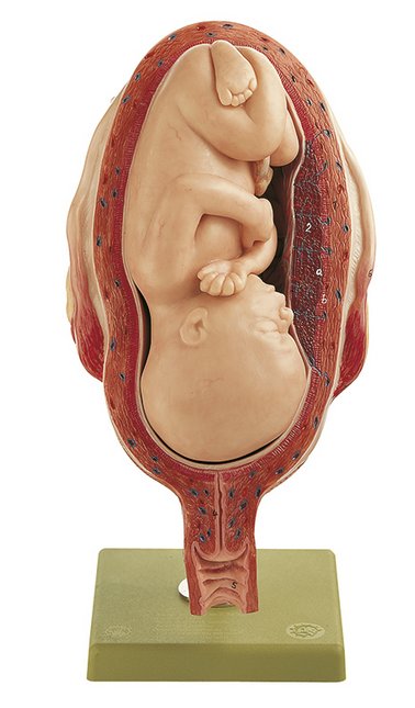 Uterus with Fetus in Seventh Month