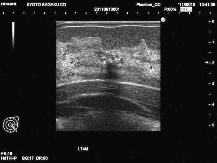 Ultraschalluntersuchungsphantom-Brust, Bestellnummer R16670