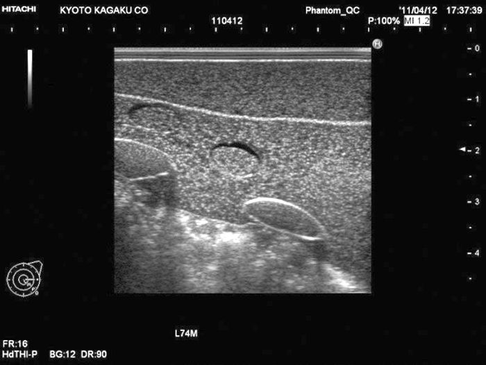 Ultraschalluntersuchungsphantom-Brust, Bestellnummer R16670