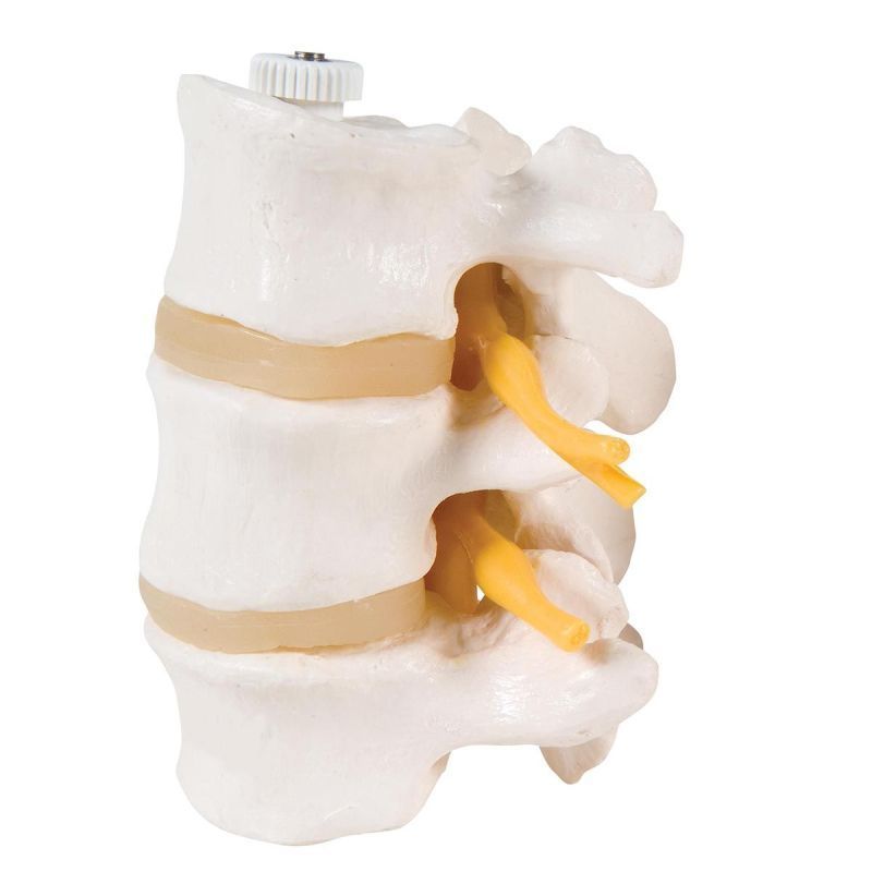 3 Lumbar Vertebrae, flexibly mounted