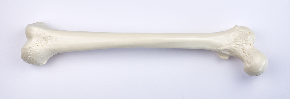 Oberschenkelknochen (Femur), Bestellnummer QS 19/1, SOMSO-Modelle