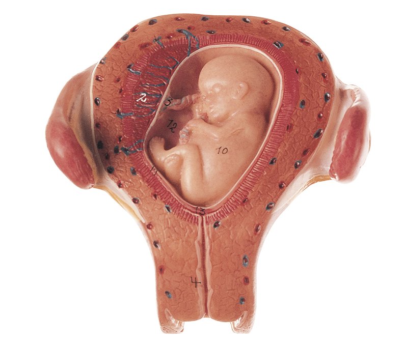 Uterus mit Embryo im 3. Monat, Bestellnummer MS 12/3, SOMSO-Modelle