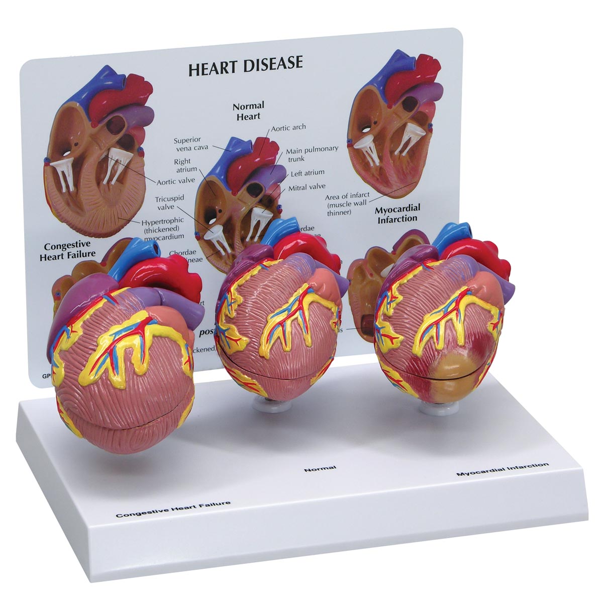 3-Mini-Herzmodell-Set, Bestellnummer 1019530, W33365, 2550, GPI Anatomicals