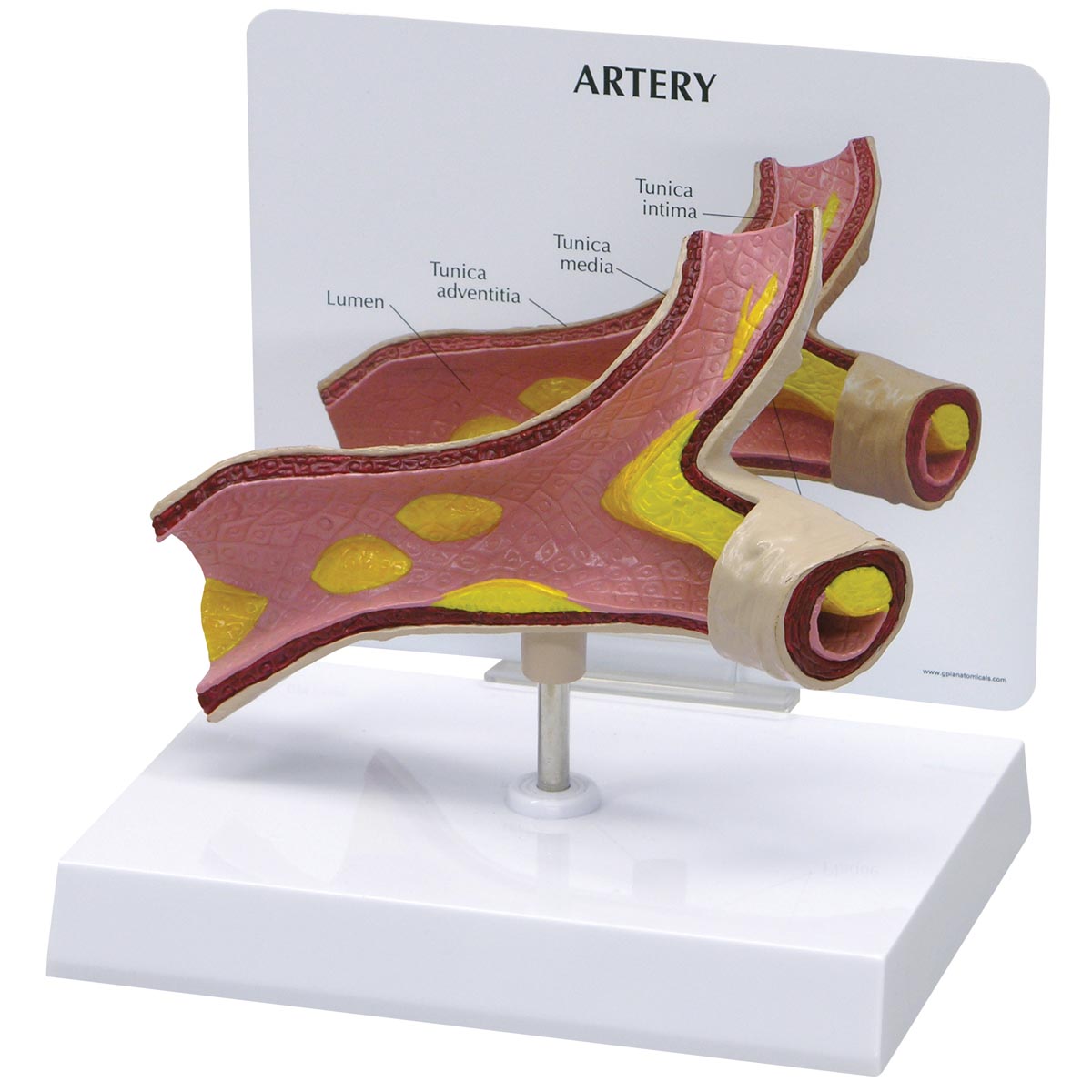 Arterienmodell, Bestellnummer 1019531, G60, 2600, GPI Anatomicals