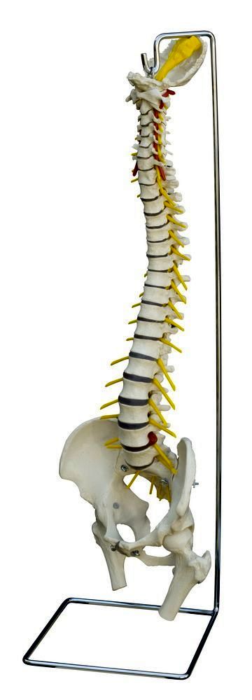 Flexible Wirbelsäule mit Bandscheibenvorfall mit Stativ und Stümpfen, schwer, Bestellnummer A211, Rüdiger-Anatomie