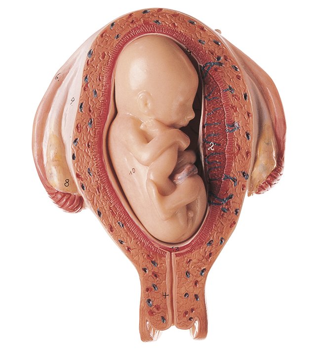 Uterus mit Fetus im 5. Monat, Bestellnummer MS 12/5, SOMSO-Modelle