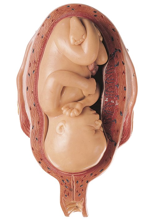 Uterus mit Fetus im 7. Monat, Bestellnummer MS 12/7, SOMSO-Modelle