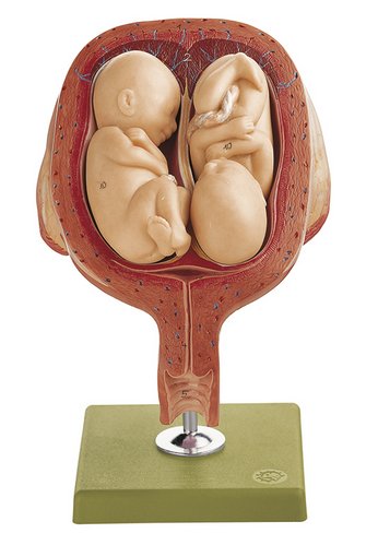 Uterus mit Zwillingsfeten im 5. Monat, Bestellnummer MS 12/8, SOMSO-Modelle