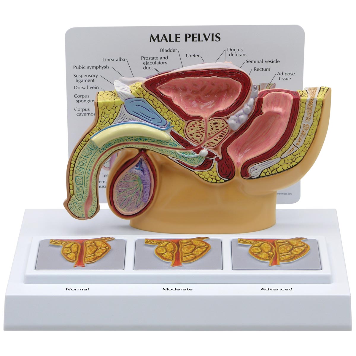 Männliches Becken mit 3D-Prostata-Rahmen, Bestellnummer 1019563, 3551, GPI Anatomicals