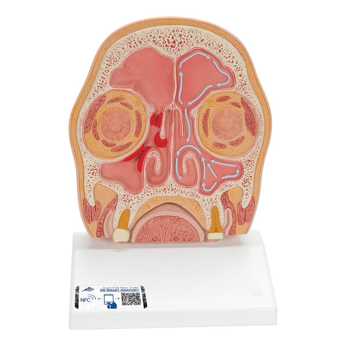 Kopfmodell frontal geschnitten in anatomischer Höhe der Nasennebenhöhlen (mit Sinusitis) - 3B Smart Anatomy, Bestellnummer 1012789, C13/1, 3B Scientific