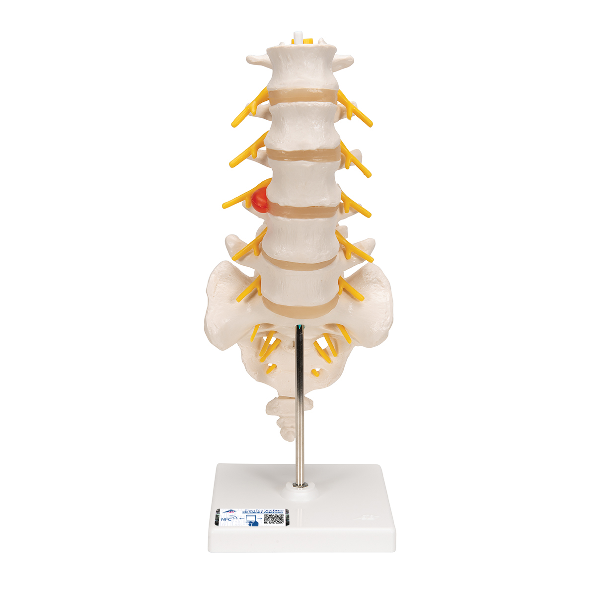 Lendenwirbelsäulenmodell mit dorsolateralem Bandscheibenvorfall - 3B Smart Anatomy, Bestellnummer 1000150, A76/5, 3B Scientific
