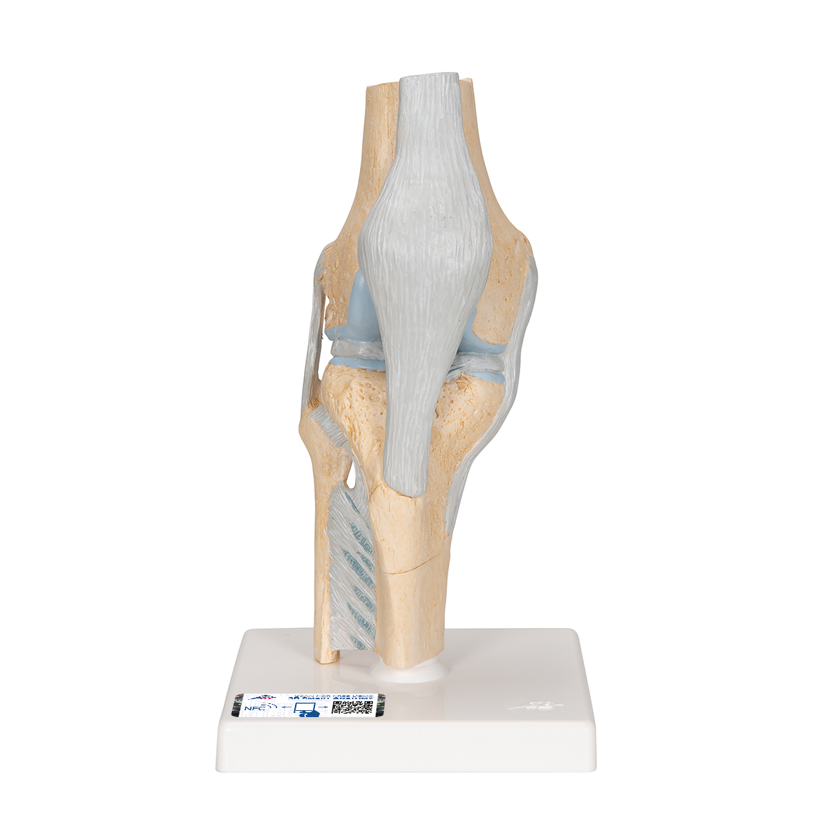 Gelenkschnitt-Modell des Knies, 3-teilig - 3B Smart Anatomy, Bestellnummer 1000180, A89, 3B Scientific