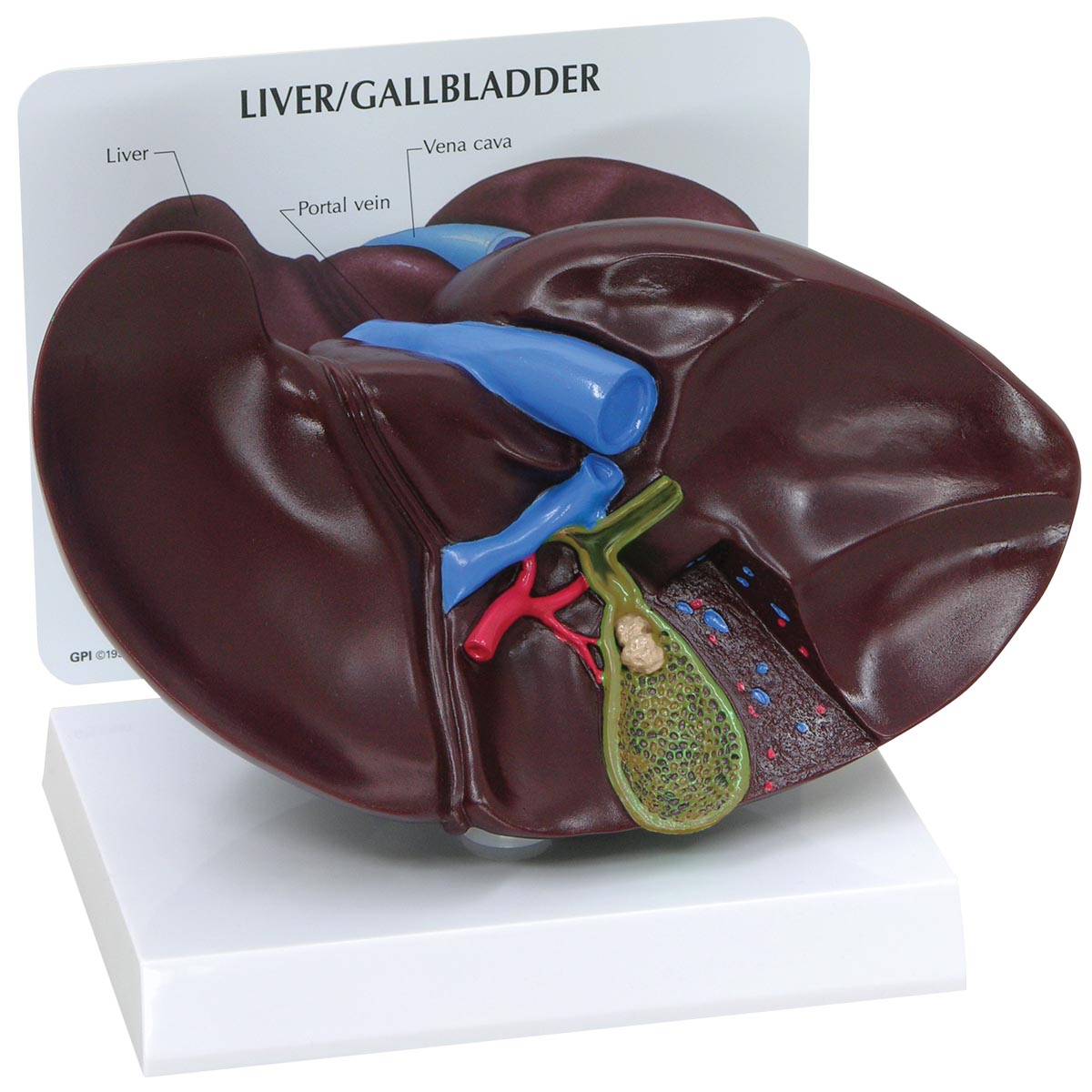 Leber-Gallenblasenmodell mit Gallensteinen, Bestellnummer 1019551, 3300, GPI Anatomicals