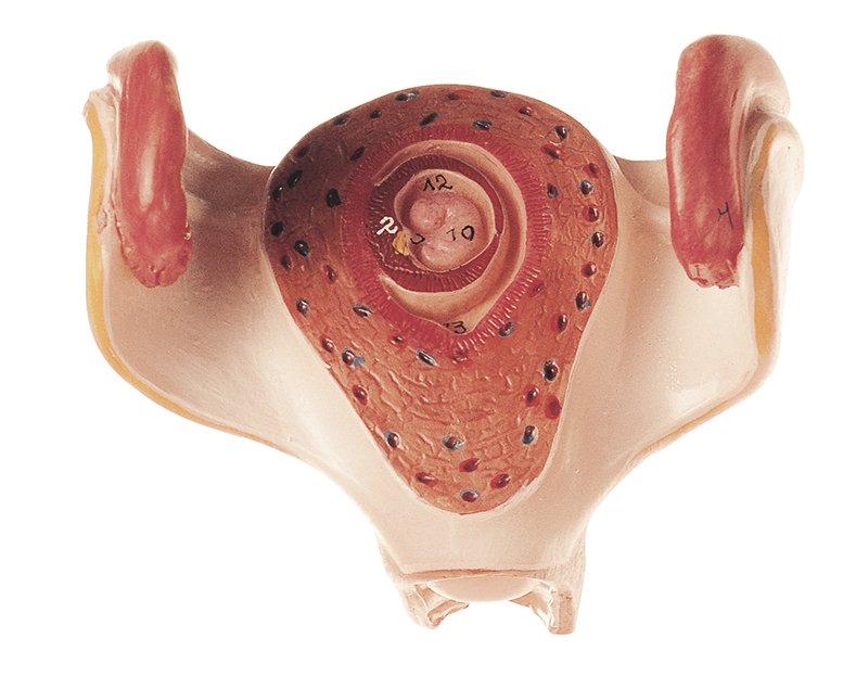 Uterus mit Embryo im 1. Monat, Bestellnummer MS 12/1, SOMSO-Modelle