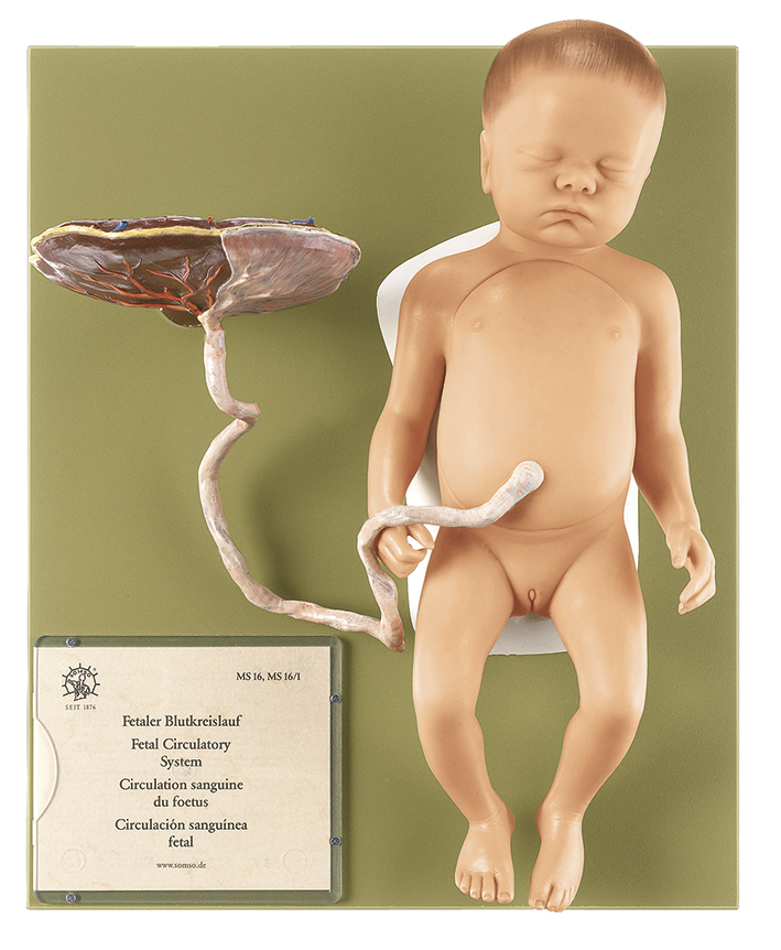 Weiblicher Fetus, Bestellnummer MS 16/1, SOMSO-Modelle