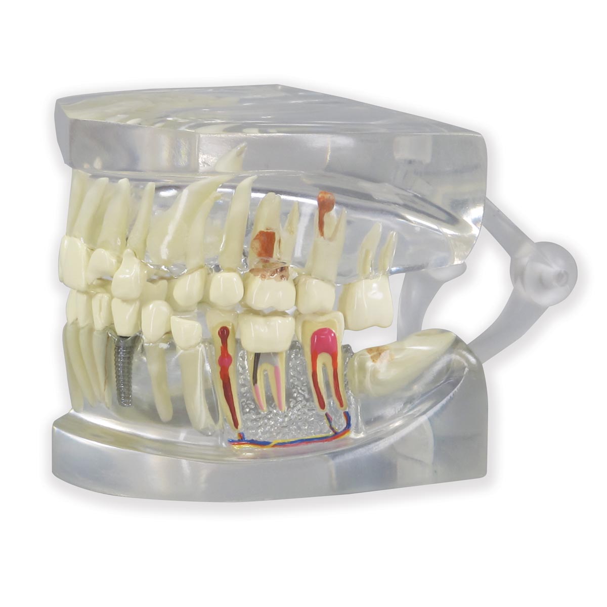 Durchsichtiger menschlicher Kiefer mit Zahnmodell, Bestellnummer 1019540, 2861, GPI Anatomicals
