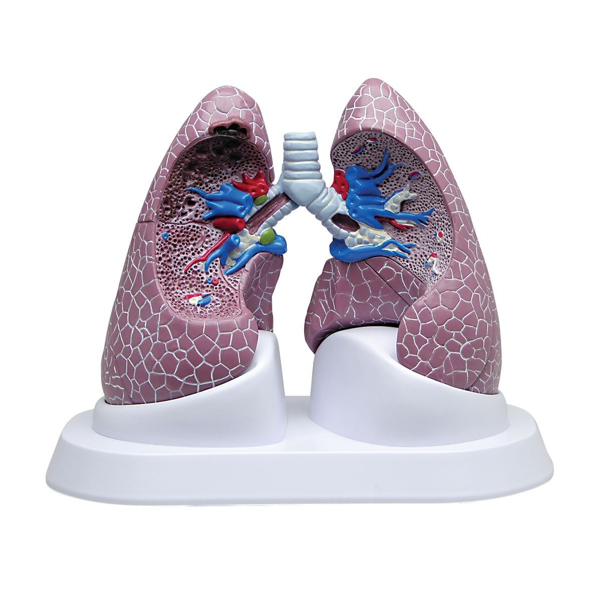 Lungen-Set mit Pathologien, Bestellnummer 1018749, W33371, 3110_SB44894G, GPI Anatomicals