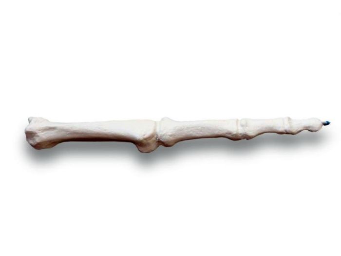 Fingerknochenstift, Bestellnummer AN14, Rüdiger-Anatomie