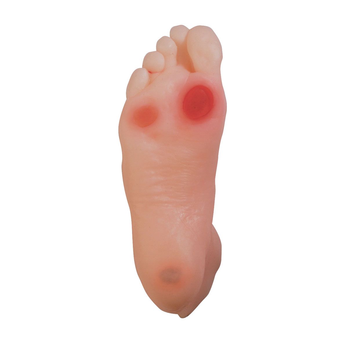 Diabetischer Fuß, Bestellnummer 1017936, W43107, 26101, WRS Group