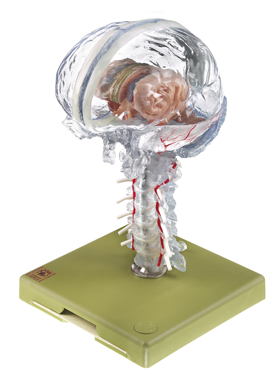 Transparentes Gehirnmodell, Bestellnummer BS 25/T, SOMSO-Modelle