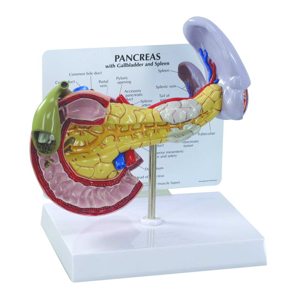 Pankreasmodell, Bestellnummer 1019553, W33367, 3330, GPI Anatomicals