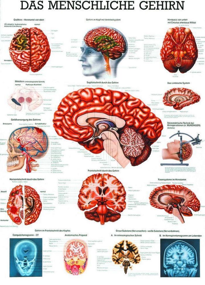 Gehirn, 23x33 cm, laminiert, Bestellnummer MIPOTA14/L, Rüdiger-Anatomie
