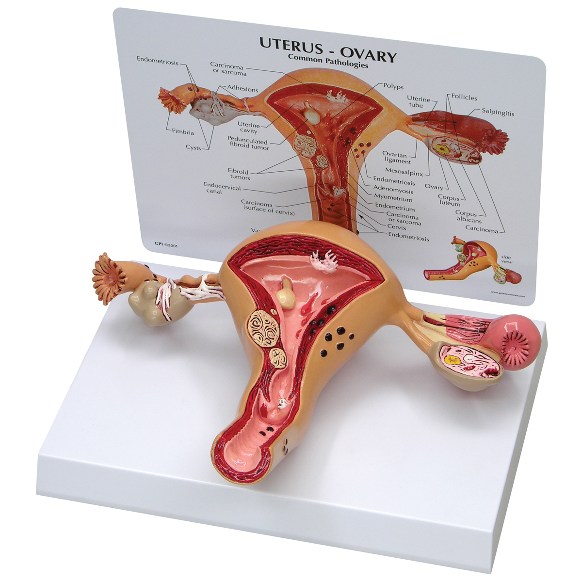 Gebärmutter-Eierstockmodell, Bestellnummer 1019594, W33352, 3480, GPI Anatomicals
