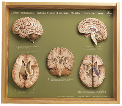 5 Gehirnschnittmodelle, Bestellnummer BS 45, SOMSO-Modelle