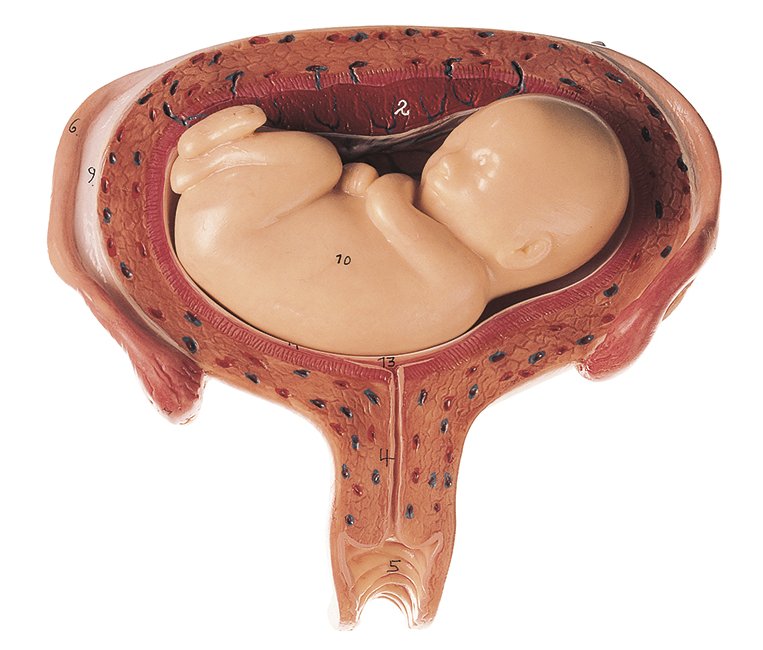 Uterus mit Fetus im 5. Monat, Bestellnummer MS 12/6, SOMSO-Modelle